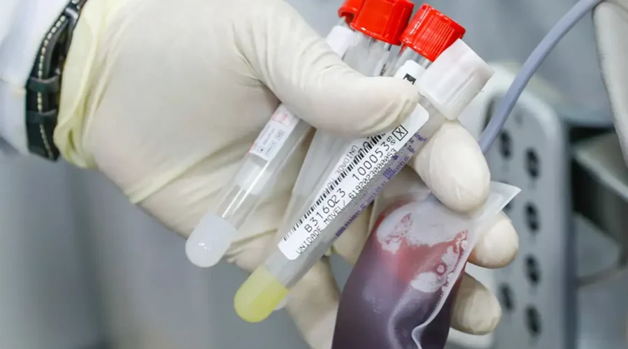 Teste rápido na detecção da febre bubônica é avaliado em campo
